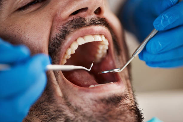 Best Emergency Root Canal Treatment in Mercersburg, PA